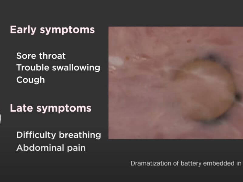 what are the symptoms of a baby swallowing a battery
